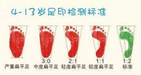 扁平足能跑步嗎？扁平足跑步有什么危害？